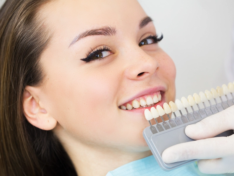 A woman smiling at a dental clinic while a gloved hand holds a tooth shade guide next to her teeth, matching the color for possible dental treatment.